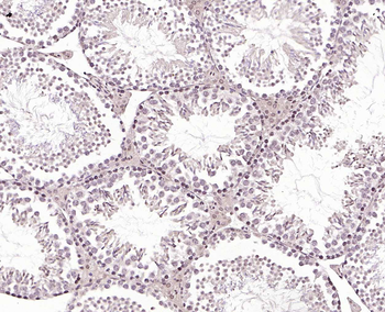 PLA2R Rabbit Polyclonal Antibo