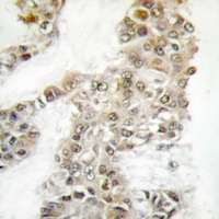 DNA-PKcs (Phospho-S2056) Antib
