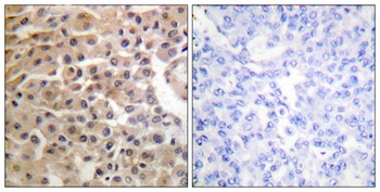 Neu (phospho Tyr1221/Y1222) ra