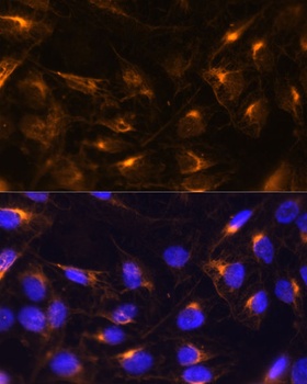 Vimentin Antibody抗体,orb1258103