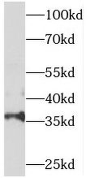 SNX20 Antibody抗体,orb631386,bio
