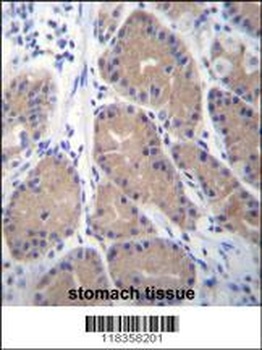 CA1 Antibody抗体，orb1269466，bior