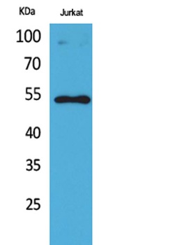 p53 (Acetyl Lys372) rabbit pAb