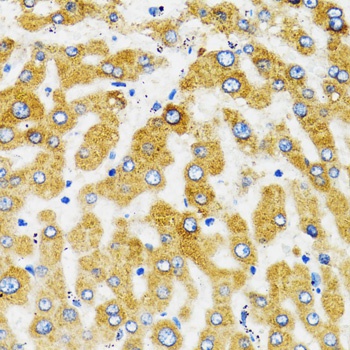 SLC27A2 Antibody抗体，orb1254964，