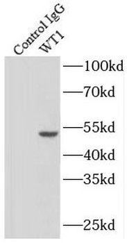 WT1 Antibody抗体，orb632626，biorb