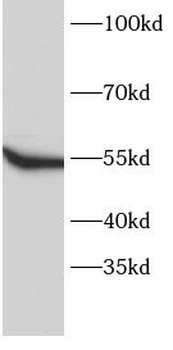 FYN Antibody抗体，orb756640，biorb