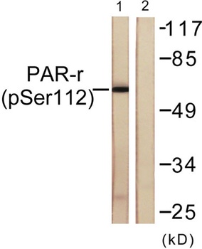 PPAR-γ (phospho Ser112) rabbit