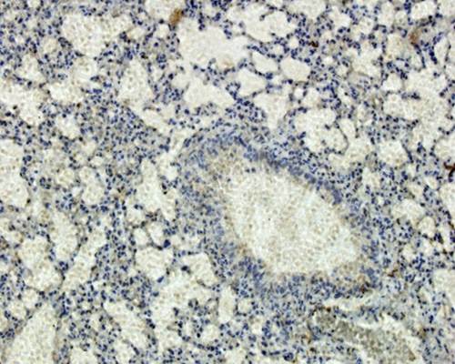 IL6 antibody抗体，orb6210，biorbyt