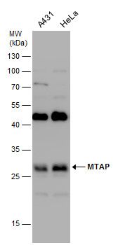MTAP antibody [N1C3]抗体，orb5565