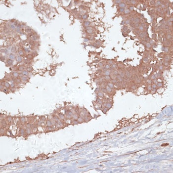 TGFBR2 Antibody抗体，orb1261146，b