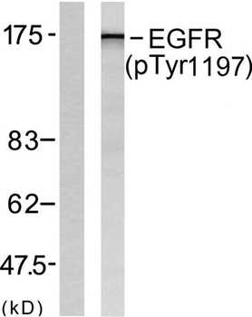 EGFR (phospho Tyr1197) rabbit 