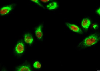 AQP2 rabbit pAb抗体，orb764563，bi