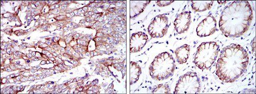 KRT19 Antibody抗体，orb69440，bior