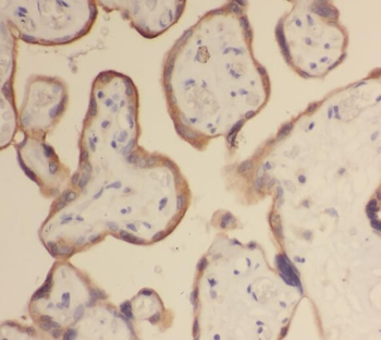 STS Antibody抗体，orb631615，biorb