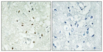 Ku-86 rabbit pAb抗体，orb765560，b