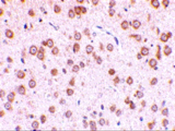 TLR5 Antibody抗体，orb1238758，bio