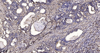 Ethanolamine kinase 2 rabbit p