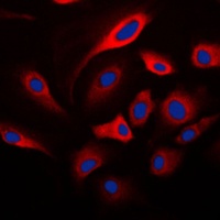 HADH2 Antibody抗体，orb214032，bio