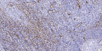 ACBD6 rabbit pAb抗体,orb764453,b