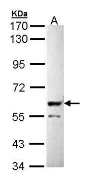 PPP3CB antibody [N1N3]抗体，orb55