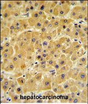F10 Antibody (C-term)抗体，orb369