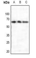 Estrogen Receptor alpha Antibo