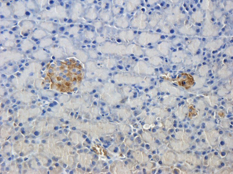 Desmocollin 1 antibody抗体，orb10