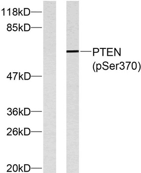 PTEN (phospho Ser370) rabbit p