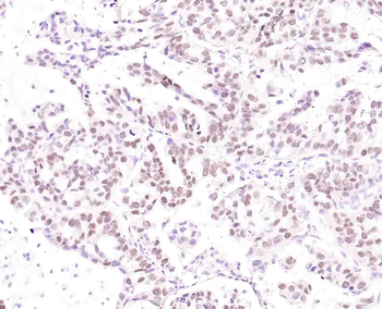 P53 Recombinant Rabbit Monoclo