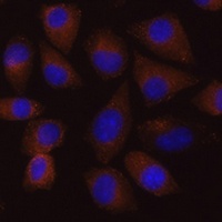 Vigilin Antibody抗体，orb666880，b