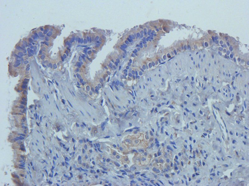 CD14 antibody抗体，orb10294，biorb