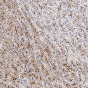 TNXB Antibody抗体，orb631810，bior