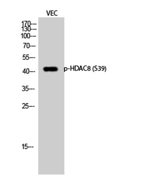 HDAC8 (phospho Ser39) rabbit p
