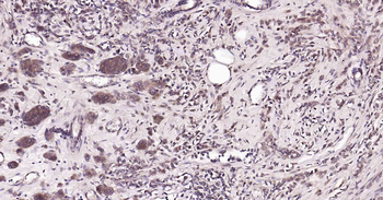 RalA Recombinant Rabbit Monocl