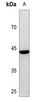 c-Jun Antibody [KO/KD Validate