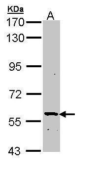 ATP6V1H antibody [N3C3]抗体，orb5