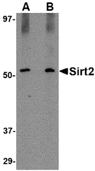 SIRT2 Antibody抗体，orb1238965，bi