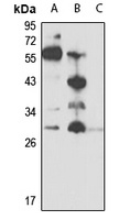 Oncostatin M Antibody抗体，orb667