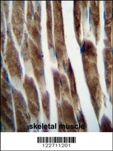 ILKAP Antibody抗体，orb1264028，bi