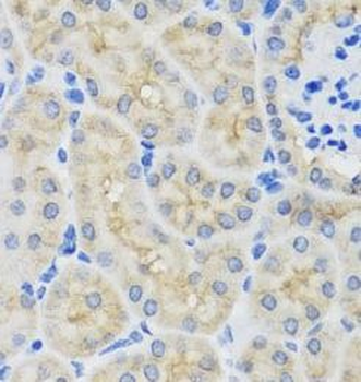 SULT1A1 Antibody抗体,orb631634,b