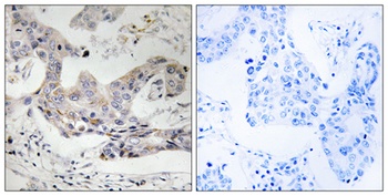 ALDH3B1 rabbit pAb抗体,orb764513