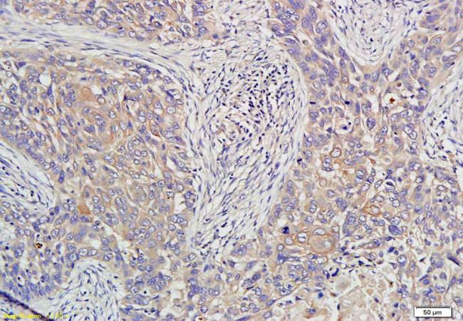 HE4 antibody抗体，orb101171，biorb