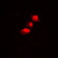 hnRNP D0 (Phospho-S83) Antibod