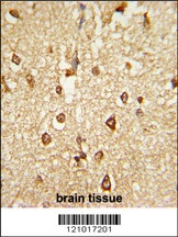 DLX2 Antibody抗体，orb1263604，bio
