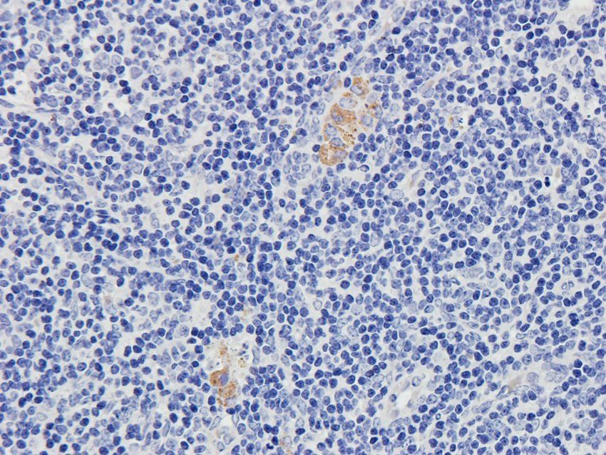 LAG3 antibody抗体，orb6286，biorby