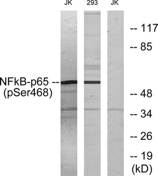 NFκB-p65 (phospho Ser468) rabb