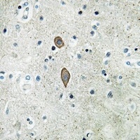 MADD Antibody抗体，orb214806，bior