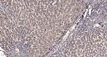 APBA2BP rabbit pAb抗体，orb764548