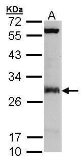 IDI1 antibody [N1C2]抗体，orb5563