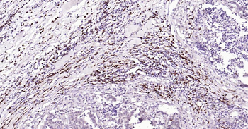 BOB1 Mouse Monoclonal Antibody